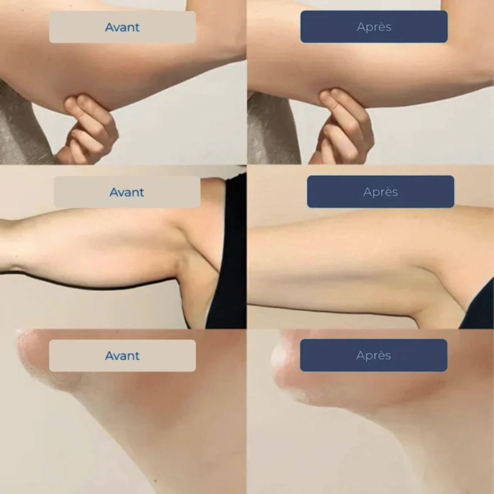 Gouttes Lymphatiques VivaFlow : Aident à réduire la rétention d’eau, les gonflements et les jambes lourdes